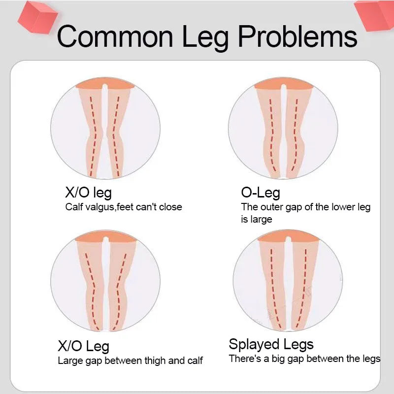 Adjustable O/X Leg Shape Correction Strap Leg Internal External Rotation Varus Valgus Straightening Tool For Adult and Child