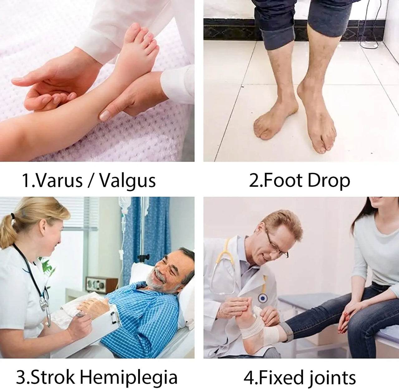 AFO Brace Drop Foot Support Splint -Medical Drop Foot Postural Correction Brace-For Fracture, Sprains,Foot Varus Orthosis Brace