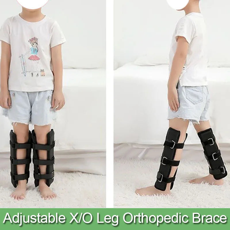 Adjustable O/X Leg Shape Correction Strap Leg Internal External Rotation Varus Valgus Straightening Tool For Adult and Child
